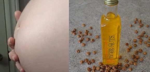 Prevent Stretch Marks During Pregnancy with Tiger Nuts Oil? Video
